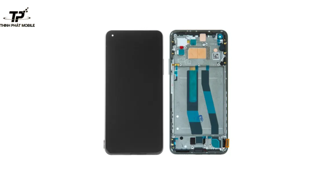 Thay màn hình Xiaomi Mi 11 Lite